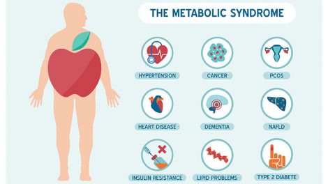 Panacea Metabolic syndrome